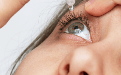 Woman adding eye drops to her eyes